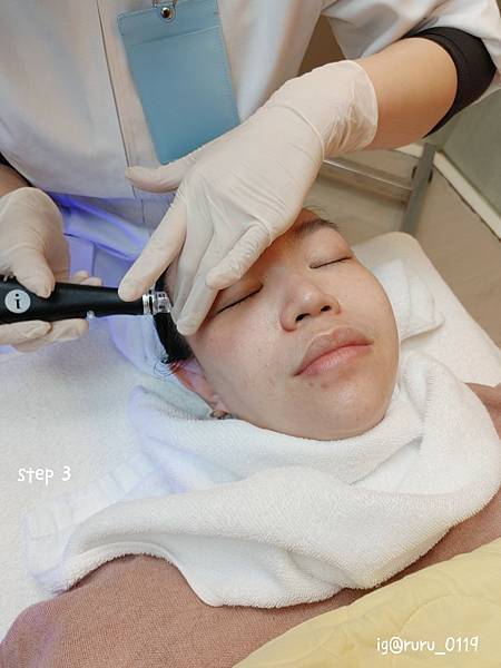 愛美 原來肌膚可以如此好 粉刺無痛bye bye 海菲秀