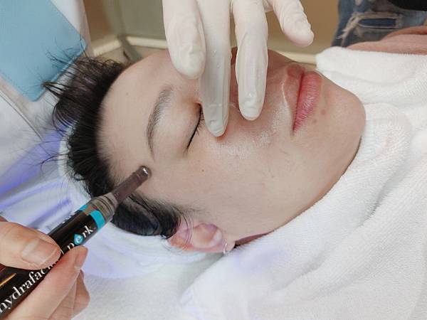 愛美 原來肌膚可以如此好 粉刺無痛bye bye 海菲秀