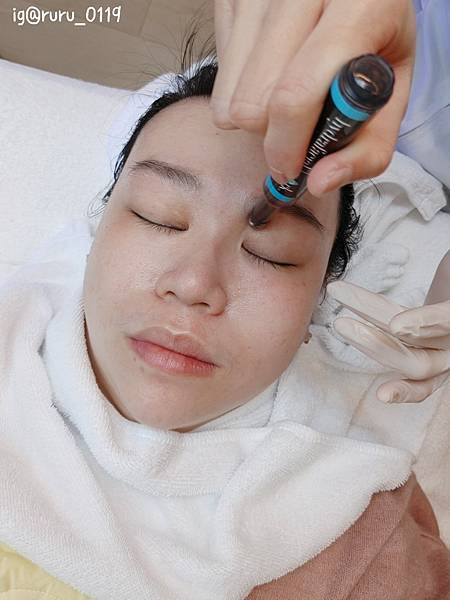 愛美 原來肌膚可以如此好 粉刺無痛bye bye 海菲秀