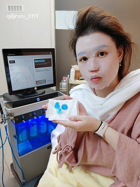 愛美 原來肌膚可以如此好 粉刺無痛bye bye 海菲秀