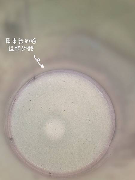 愛美 原來肌膚可以如此好 粉刺無痛bye bye 海菲秀