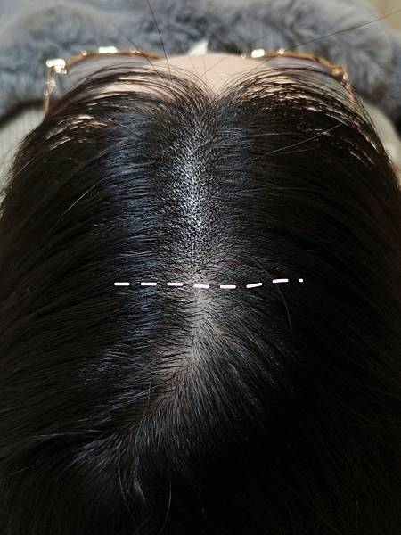 愛美 | 桃園紋髮推薦 FKB美學 正宗SMP韓式頭皮紋髮 