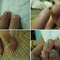 thumb