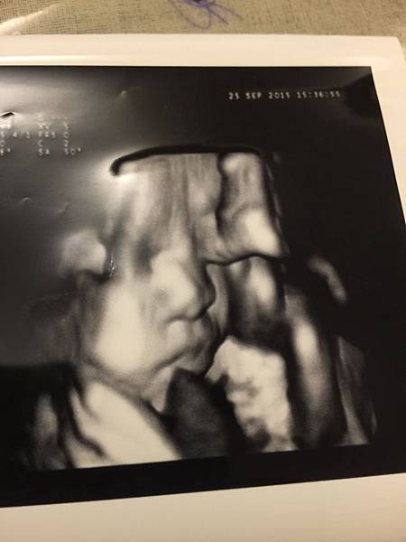 21701943145_7f923b808d_o 21701943145_7f923b808d_o