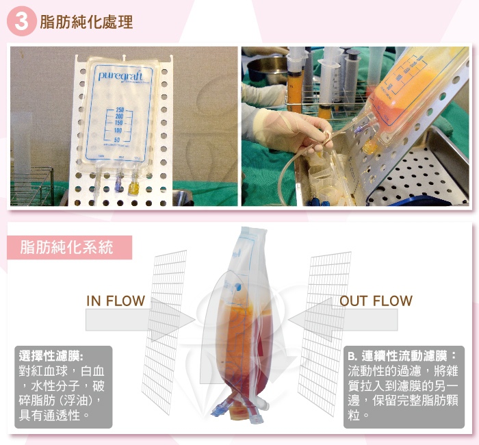 補臉流程-02 (1).jpg