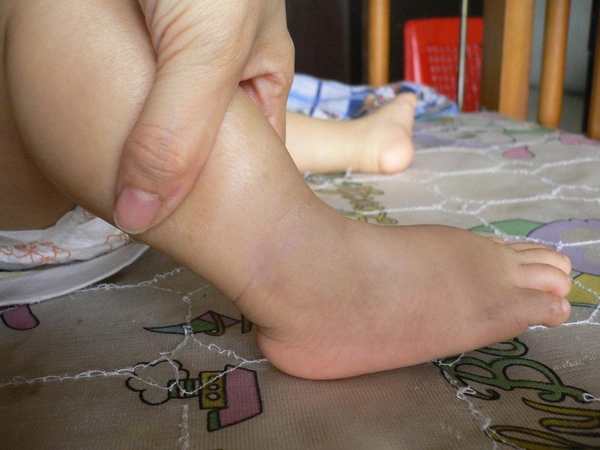 紫外线我不怕,宝宝夏天防晒的必备品--贝恩婴儿防晒乳