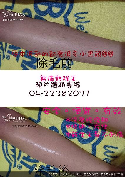 小腿.jpg 小腿.jpg