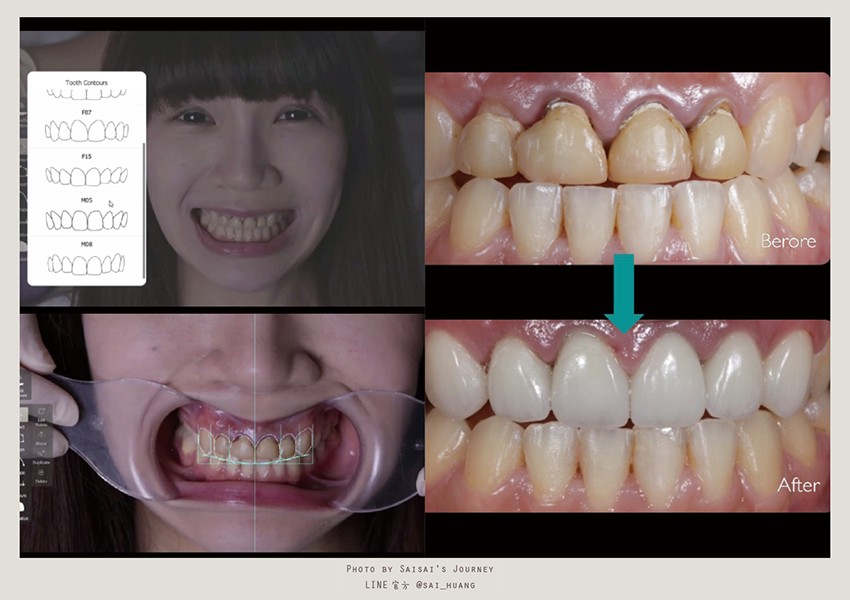 悅庭牙醫 05.png 悅庭牙醫 05.png