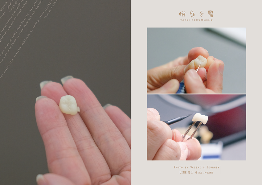 悅庭牙醫 17.png 悅庭牙醫 17.png