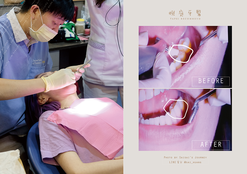 悅庭牙醫 20.png 悅庭牙醫 20.png