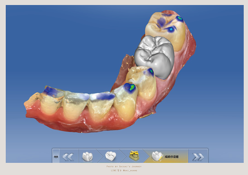 悅庭牙醫 22.png 悅庭牙醫 22.png