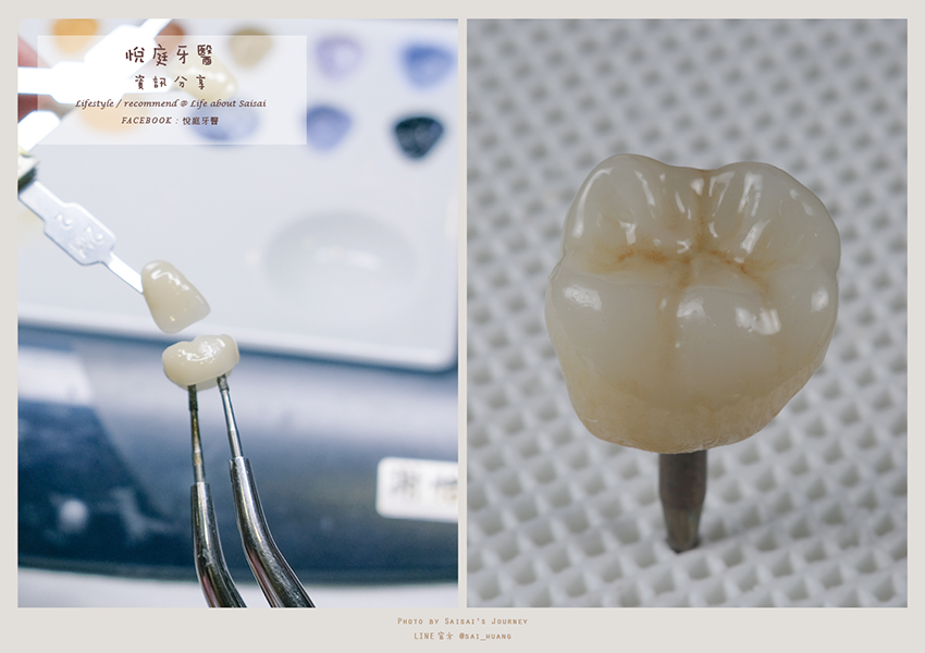 悅庭牙醫 18.png 悅庭牙醫 18.png