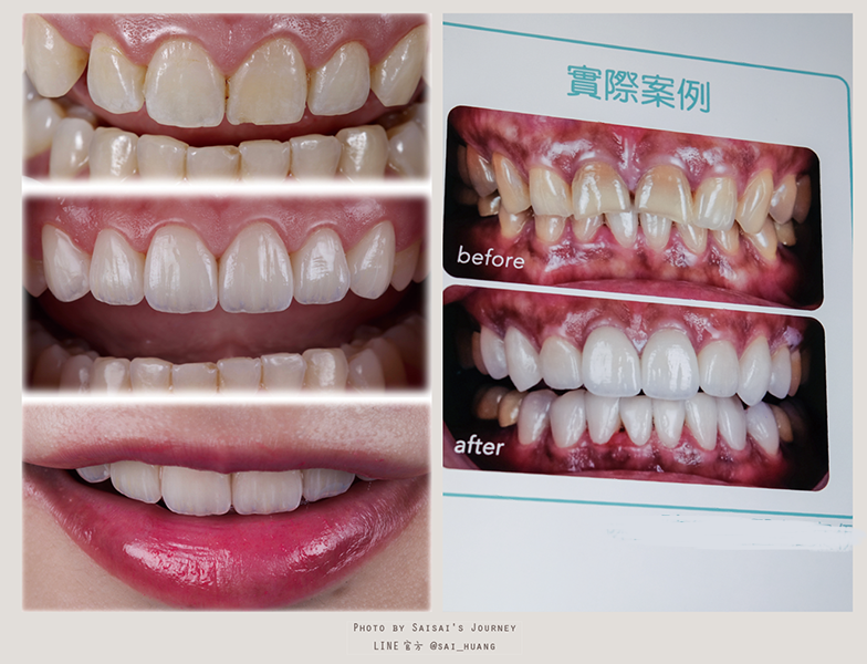 悅庭牙醫 04.png 悅庭牙醫 04.png