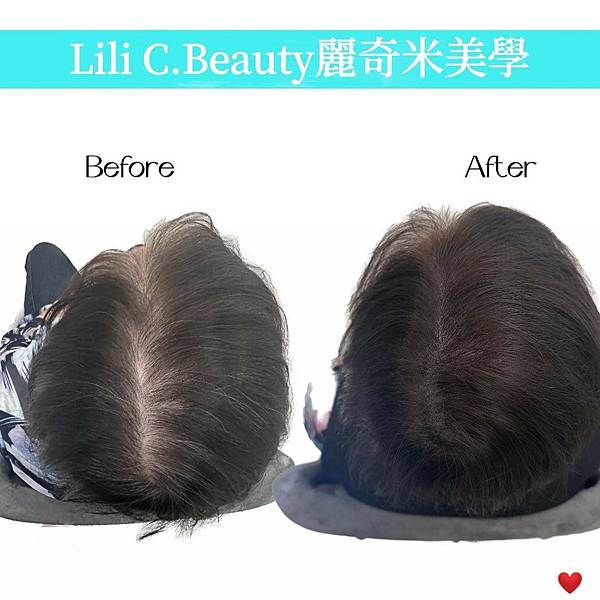 我做了「韓國SMP紋髮」好後悔! LiliC.Beauty麗