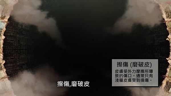 4擦傷.jpg 4擦傷.jpg