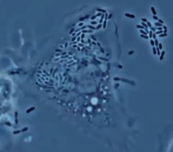 Macrophage.jpg Macrophage.jpg