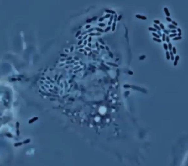 Macrophage.jpg Macrophage.jpg