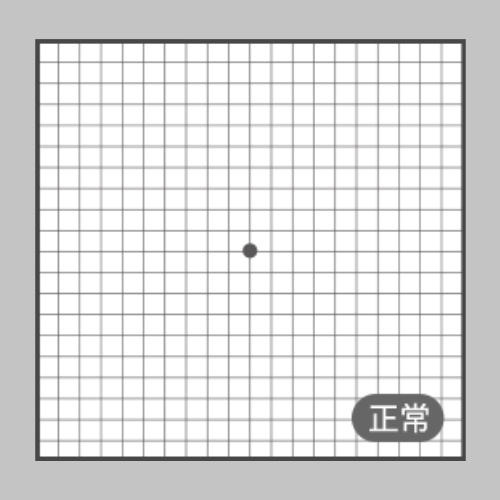 阿姆斯勒方格表(AMSLER GRID)正常.jpg