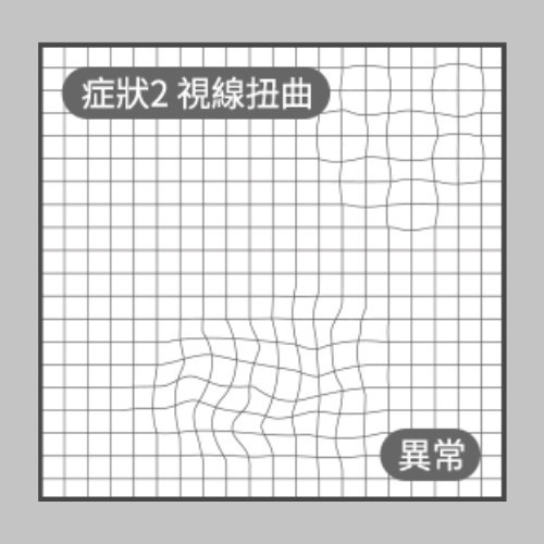 阿姆斯勒方格表(AMSLER GRID)異常2.jpg