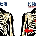 正常的肋骨與打開的肋骨.jpg