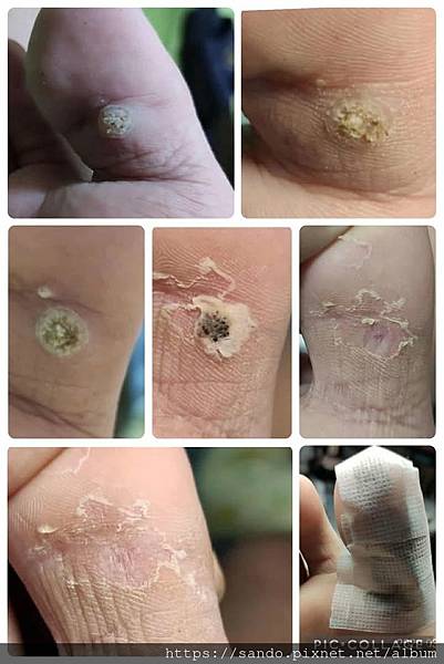 ❤蔡_夏媽妳好!!兒子用了全好了，謝謝妳!! 可否給妳聯絡電