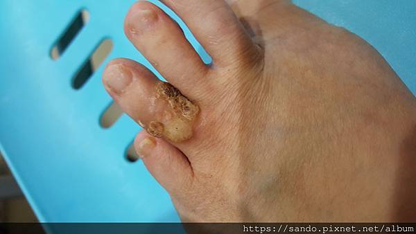 蔡瓊瑩足趾頭縫隙8.jpg