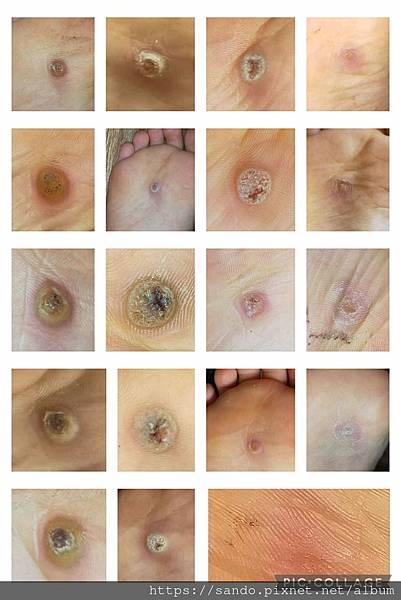 2025-8-27Maggie Wu痊癒拼圖.jpg