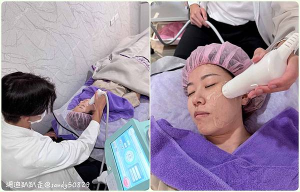 龍捲風音波拉提體驗 // 台北音波拉提診所分享｜愛爾麗診所H