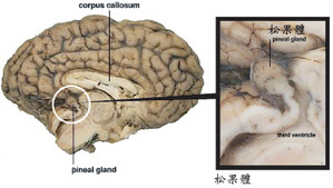 松果體5