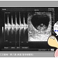 【孕事】♥ 懷孕十月 ♥ 第八週 可愛的小手手 小腳腳出現囉!