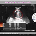 第三十二週又四天 -3