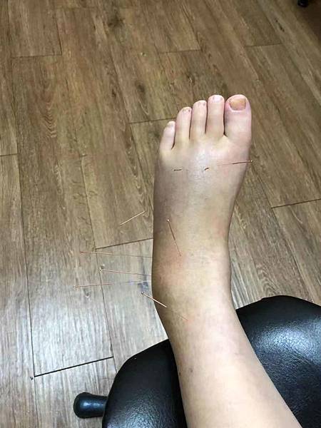 1211 acupunture 2.jpg 1211 acupunture 2.jpg