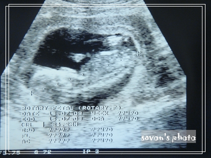 my baby 13W my baby 13W