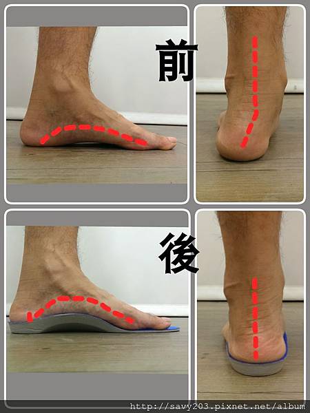 鞋墊穿著前後citywalk 鞋墊穿著前後citywalk