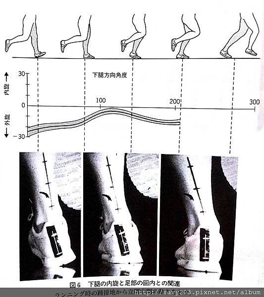 orthosed foot (1)-170000