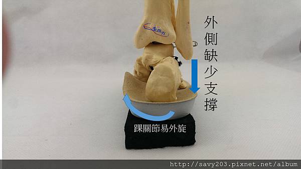 足跟墊高後視 足跟墊高後視