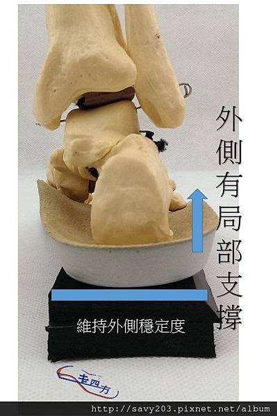 正確增高墊視 正確增高墊視