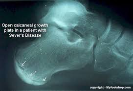 images (2) images (2)