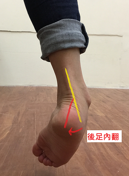 機制 後足內翻 機制 後足內翻