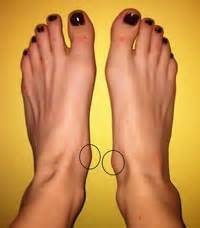 突出的舟狀骨.jpg 突出的舟狀骨.jpg