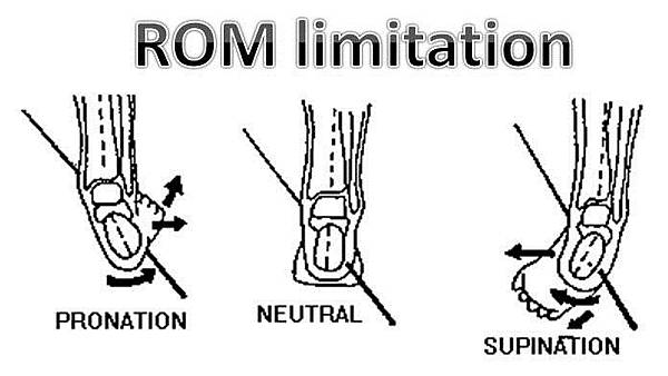 STJ limitation.jpg STJ limitation.jpg