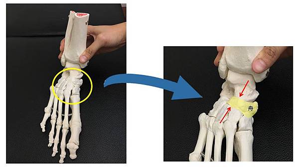 舟狀骨 簡單版.jpg 舟狀骨 簡單版.jpg