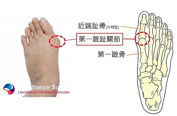 關節介紹0-2.jpg 關節介紹0-2.jpg