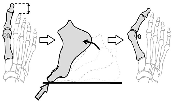 較長的大姆趾2  (Munuera, Polo, %26; Rebollo, 2008).PNG