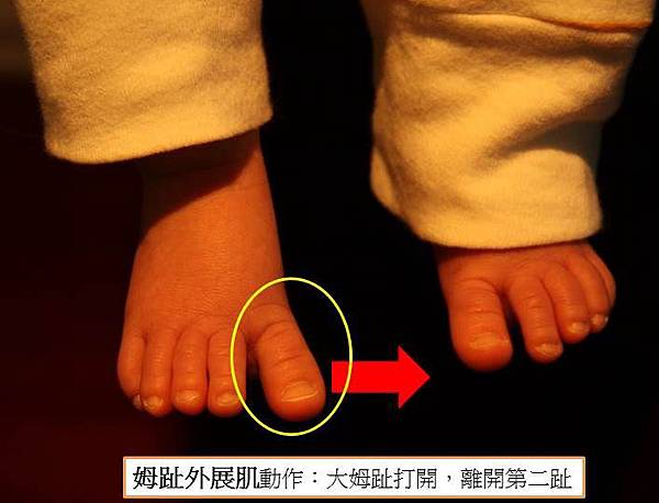 abd hallucis motion-1.jpg abd hallucis motion-1.jpg