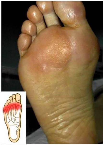 HV MTSA 2.jpg HV MTSA 2.jpg