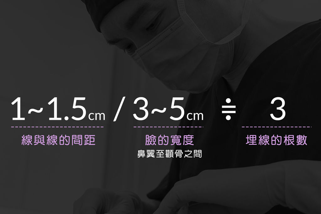 埋線拉提DNA螺旋式拉提埋線拉提副作用埋線拉提失敗埋線拉提費用埋線拉提推薦03.jpg 埋線拉提DNA螺旋式拉提埋線拉提副作用埋線拉提失敗埋線拉提費用埋線拉提推薦03.jpg