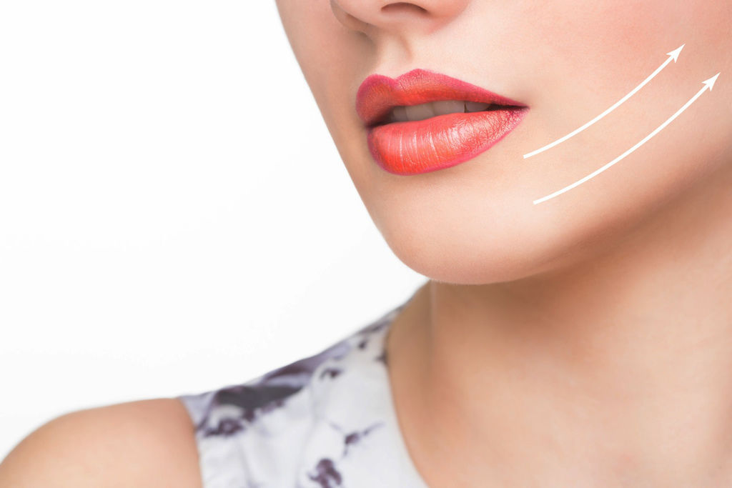 埋線拉提埋線拉提副作用埋線拉提失敗埋線拉提費用埋線拉提推薦埋線拉皮後遺症埋線拉提術後02.jpg 埋線拉提埋線拉提副作用埋線拉提失敗埋線拉提費用埋線拉提推薦埋線拉皮後遺症埋線拉提術後02.jpg