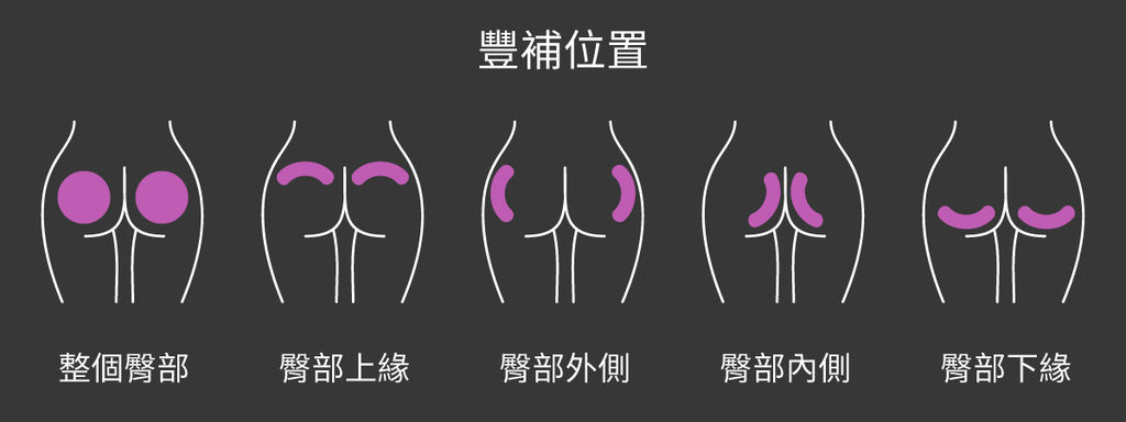 臀部抽脂抽脂手術風險抽脂價格抽脂後遺症抽脂日記抽脂會痛嗎04.jpg 臀部抽脂抽脂手術風險抽脂價格抽脂後遺症抽脂日記抽脂會痛嗎04.jpg