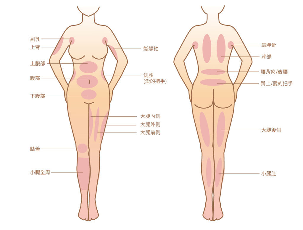 渦旋氣動抽脂渦旋抽脂光彩時尚診所抽脂微笑抽脂光彩時尚診所評價肚子抽脂肪抽脂推薦局部抽脂03.jpg 渦旋氣動抽脂渦旋抽脂光彩時尚診所抽脂微笑抽脂光彩時尚診所評價肚子抽脂肪抽脂推薦局部抽脂03.jpg